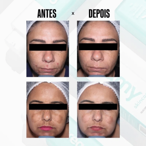 GLICOINTENSE PEEL 30G - CREAMY