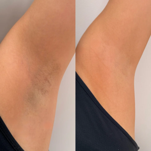 Majesty  Desodorante   Antitranspirante  Roll-On  55ml - Bloom